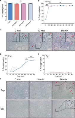 The Regulatory Effect of Coaggregation Between Fusobacterium nucleatum and Streptococcus gordonii on the Synergistic Virulence to Human Gingival Epithelial Cells